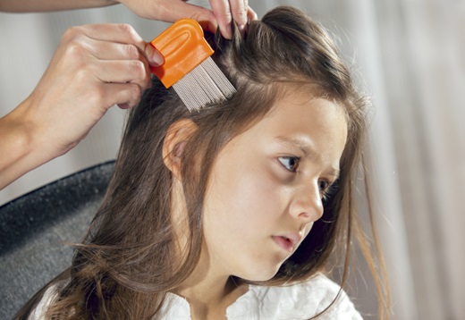 Head Lice Treatments